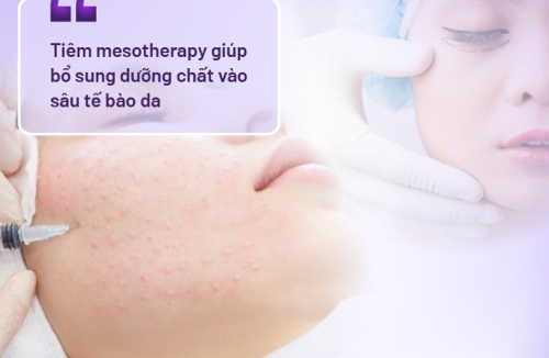 Có nên tiêm mesotherapy? Tiêm có tác dụng phụ không?